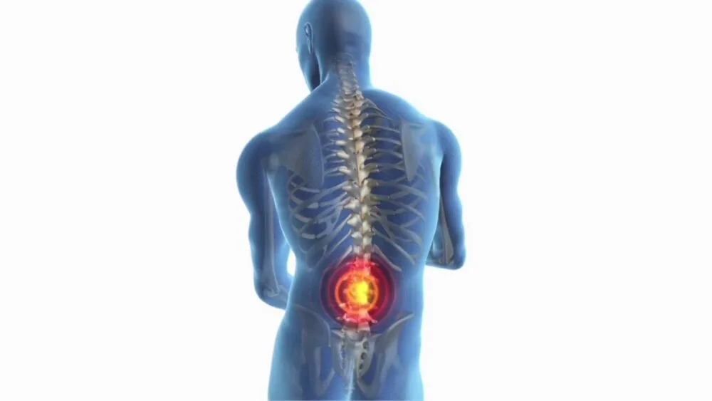 Can Creatine Cause Back Pain?