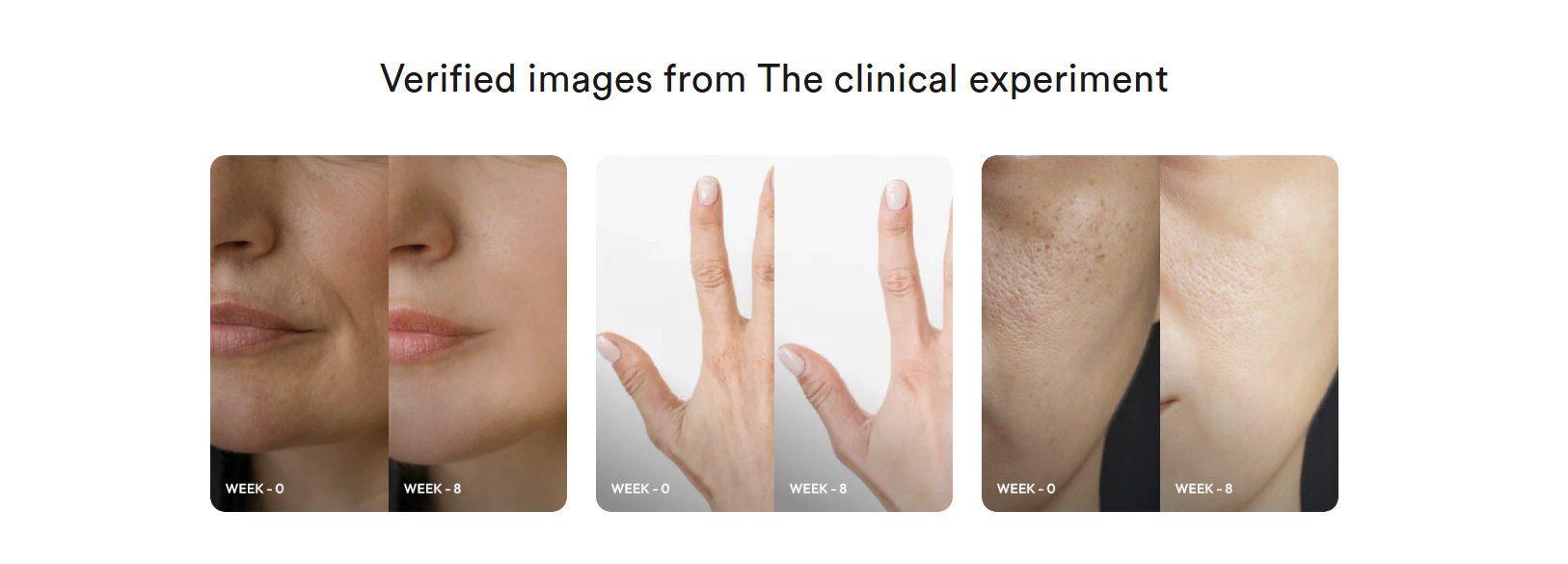 Vegan Pro Collagen Lemon Lime 16 Vegan Pro Collagen Lemon Lime